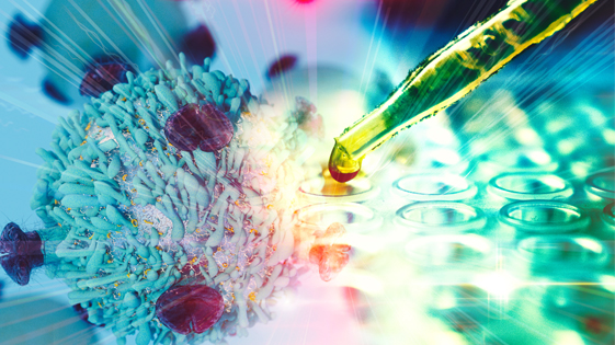 Oncology-Excellence